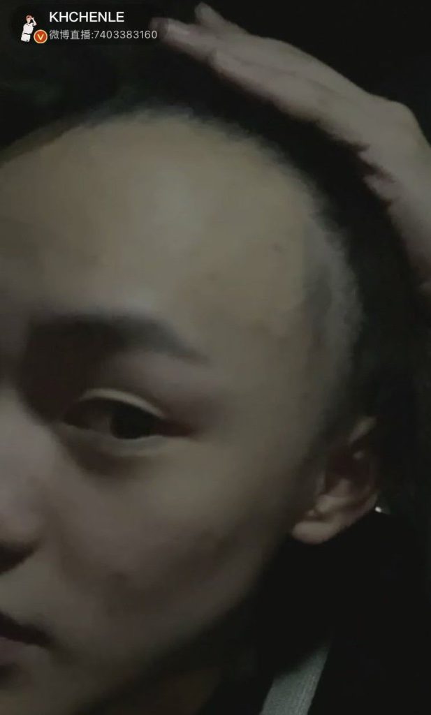 Fans preocupados por pérdida de cabello de Chenle de NCT