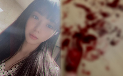 Mina ex AOA comparte una sangrienta foto de autolesión en su cuenta de Instagram